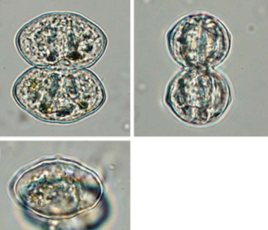 Cosmarium pseudoprotuberans